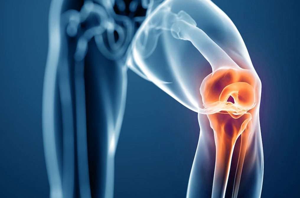 Knee Replacement KreedOn physical therapy